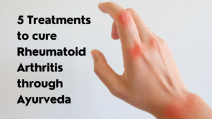 5 Treatments to cure Rheumatoid arthritis through Ayurveda