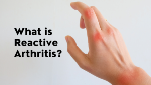 What is Reactive Arthritis?
