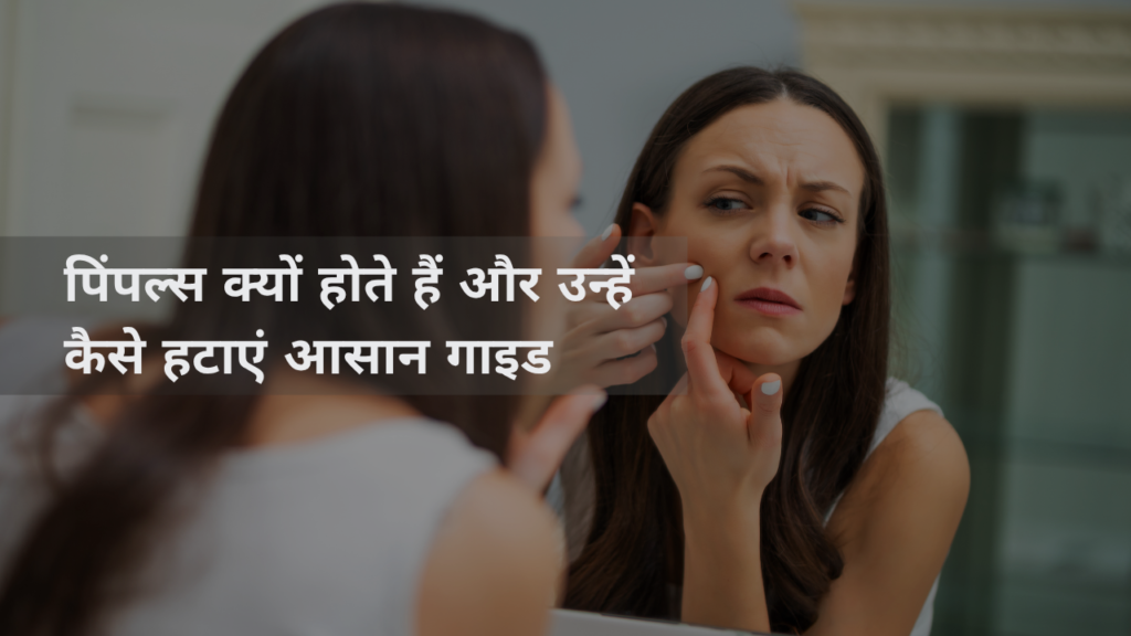 मुँहासे क्यों होते हैं और उनसे जल्दी छुटकारा कैसे पाएं?